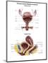 Anterior View and Sagittal View of Female Urinary Bladder-Stocktrek Images-Mounted Art Print