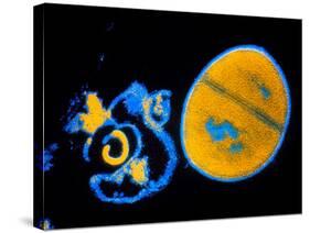 Antibiotic Action on Staphylococcus-null-Stretched Canvas