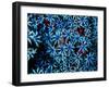 Antozoa-Andrea Ferrari-Framed Photographic Print