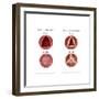 Aortic Valve Comparison-Monica Schroeder-Framed Art Print