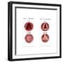 Aortic Valve Comparison-Monica Schroeder-Framed Art Print