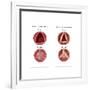 Aortic Valve Comparison-Monica Schroeder-Framed Art Print