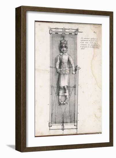 Apparatus Intended to Correct Bow Legs-Langlume-Framed Art Print