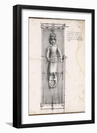 Apparatus Intended to Correct Bow Legs-Langlume-Framed Art Print