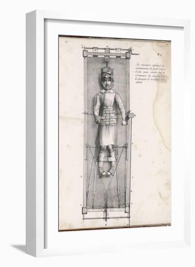 Apparatus Intended to Correct Bow Legs-Langlume-Framed Art Print