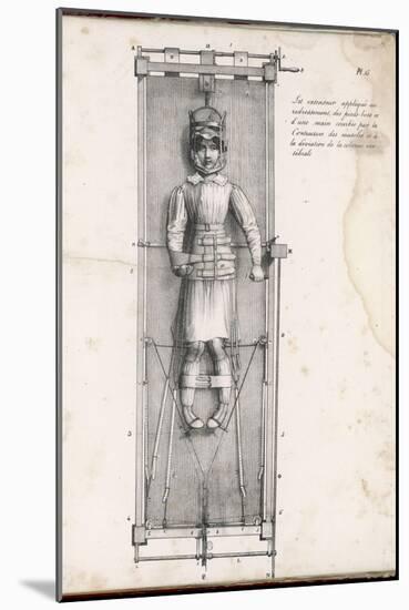Apparatus Intended to Correct Bow Legs-Langlume-Mounted Art Print