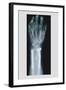 Arm and Finger Repair-null-Framed Art Print