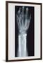 Arm and Finger Repair-null-Framed Art Print