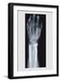 Arm and Finger Repair-null-Framed Art Print