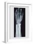 Arm and Finger Repair-null-Framed Art Print