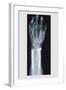 Arm and Finger Repair-null-Framed Art Print