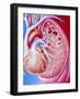 Art of Pulmonary Tuberculosis with Lung Cavities-John Bavosi-Framed Photographic Print