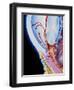 Art of Section Through Human Eye Showing Glaucoma-John Bavosi-Framed Premium Photographic Print