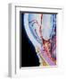 Art of Section Through Human Eye Showing Glaucoma-John Bavosi-Framed Premium Photographic Print