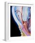 Art of Section Through Human Eye Showing Glaucoma-John Bavosi-Framed Photographic Print