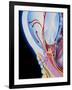 Art of Section Through Human Eye Showing Glaucoma-John Bavosi-Framed Photographic Print