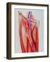 Arterial Bypass-John Bavosi-Framed Photographic Print