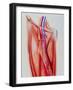 Arterial Bypass-John Bavosi-Framed Photographic Print