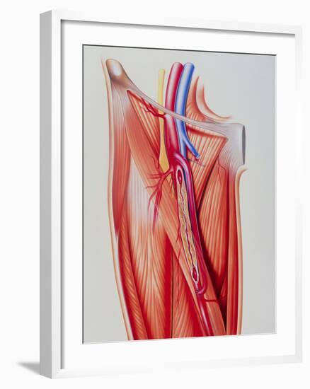 Arterial Bypass-John Bavosi-Framed Photographic Print