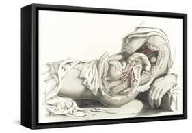 Arteries, Female Pelvis, 19th Century-Science Source-Framed Stretched Canvas