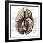 Arteries of the Brain-Science Source-Framed Giclee Print