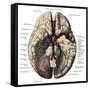 Arteries of the Brain-Science Source-Framed Stretched Canvas