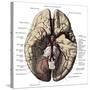 Arteries of the Brain-Science Source-Stretched Canvas