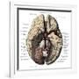 Arteries of the Brain-Science Source-Framed Giclee Print