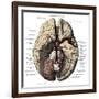 Arteries of the Brain-Science Source-Framed Giclee Print