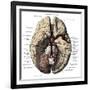 Arteries of the Brain-Science Source-Framed Giclee Print