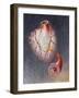Arteries on Heart Showing Atherosclerotic Plaque in an Artery-null-Framed Art Print