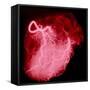 Arteriograph of the Coronary Arteries of the Heart-Science Photo Library-Framed Stretched Canvas