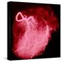 Arteriograph of the Coronary Arteries of the Heart-Science Photo Library-Stretched Canvas
