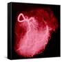 Arteriograph of the Coronary Arteries of the Heart-Science Photo Library-Framed Stretched Canvas