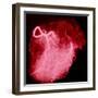 Arteriograph of the Coronary Arteries of the Heart-Science Photo Library-Framed Premium Photographic Print