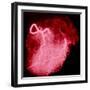 Arteriograph of the Coronary Arteries of the Heart-Science Photo Library-Framed Premium Photographic Print