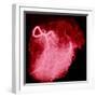 Arteriograph of the Coronary Arteries of the Heart-Science Photo Library-Framed Premium Photographic Print