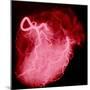 Arteriograph of the Coronary Arteries of the Heart-Science Photo Library-Mounted Premium Photographic Print
