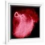 Arteriograph of the Coronary Arteries of the Heart-Science Photo Library-Framed Photographic Print