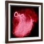 Arteriograph of the Coronary Arteries of the Heart-Science Photo Library-Framed Photographic Print