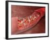 Artery Cross-section with Blood Flow And Stent Deployment-Stocktrek Images-Framed Photographic Print
