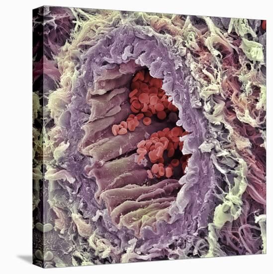 Artery SEM-Steve Gschmeissner-Stretched Canvas