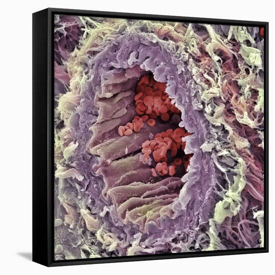 Artery SEM-Steve Gschmeissner-Framed Stretched Canvas