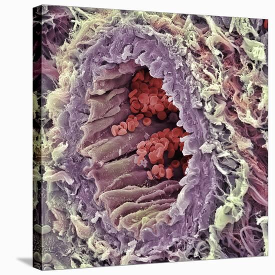 Artery SEM-Steve Gschmeissner-Stretched Canvas