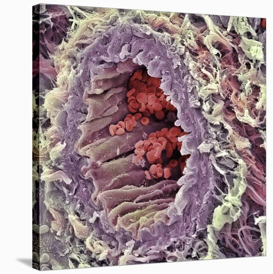 Artery SEM-Steve Gschmeissner-Stretched Canvas