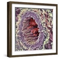 Artery SEM-Steve Gschmeissner-Framed Premium Photographic Print