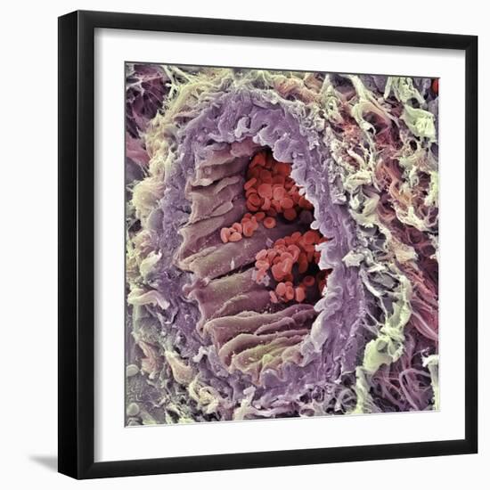 Artery SEM-Steve Gschmeissner-Framed Premium Photographic Print