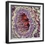 Artery SEM-Steve Gschmeissner-Framed Premium Photographic Print