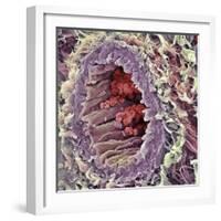 Artery SEM-Steve Gschmeissner-Framed Premium Photographic Print