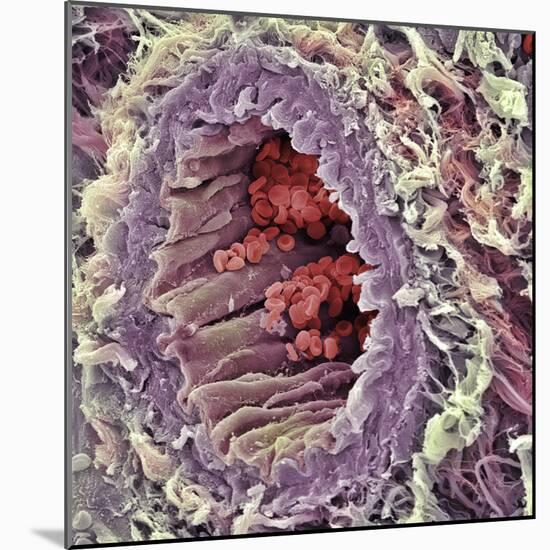 Artery SEM-Steve Gschmeissner-Mounted Premium Photographic Print